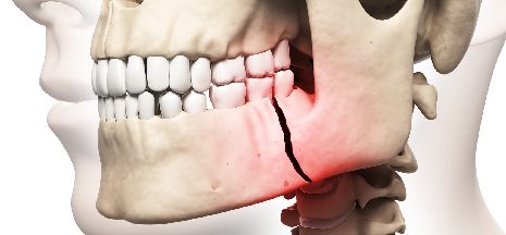 Un hombre denunció apremios tras ser trasladado por la Policía y aparecer con graves lesiones en el hospital